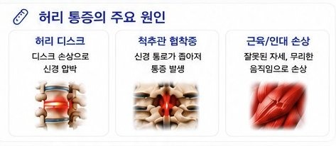 허리 통증의 주요 원인 - 허리 디스크, 척추관 협착증, 근육·인대 손상