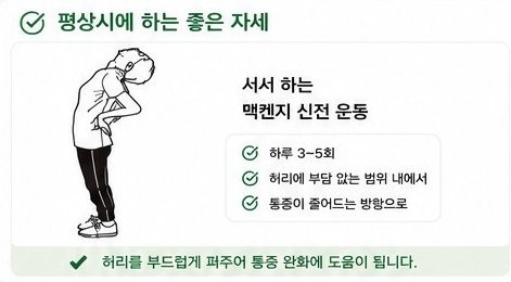 평상시 좋은 자세 - 서서 하는 맥켄지 신전 운동