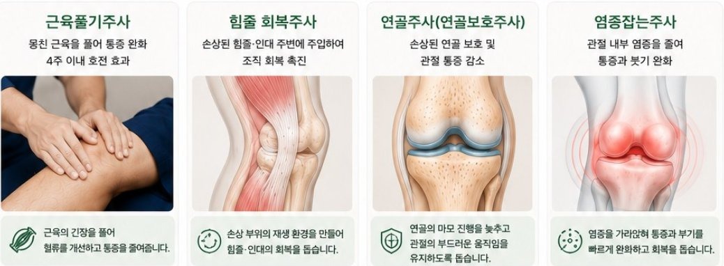 주사 4종 - 근육풀기, 힘줄 회복, 연골, 염증 잡는 주사