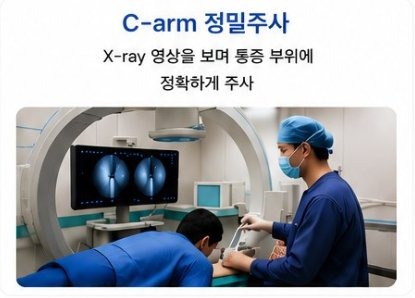 C-arm 정밀주사