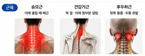 근육 - 승모근, 견갑거근, 후두하근