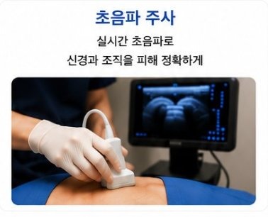 초음파 주사