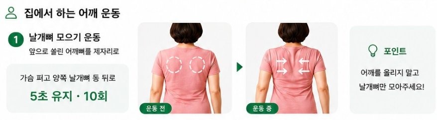 날개뼈 모으기 운동 - 5초 유지 10회
