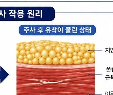 풀린 상태