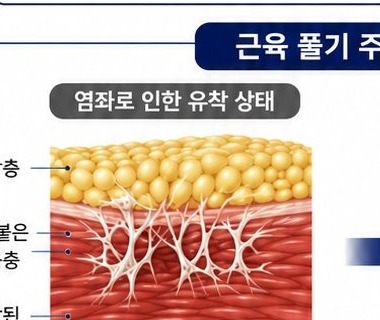 염좌 상태